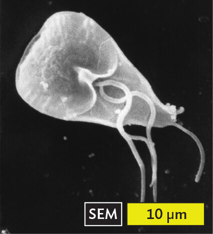 A scanning electron micrograph of Giardia lamblia.