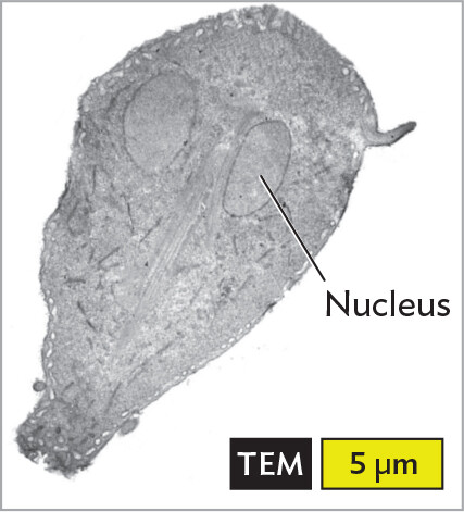 A transmission electron micrograph of Giardia lamblia.