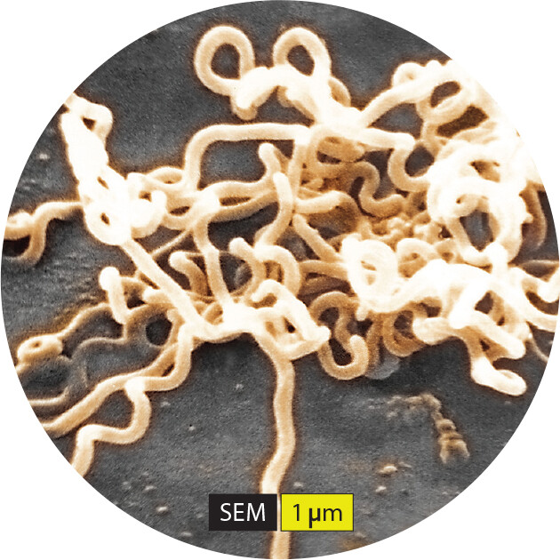 A scanning electron micrograph of Treponema pallidum.