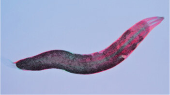 A micrograph of a pinworm.