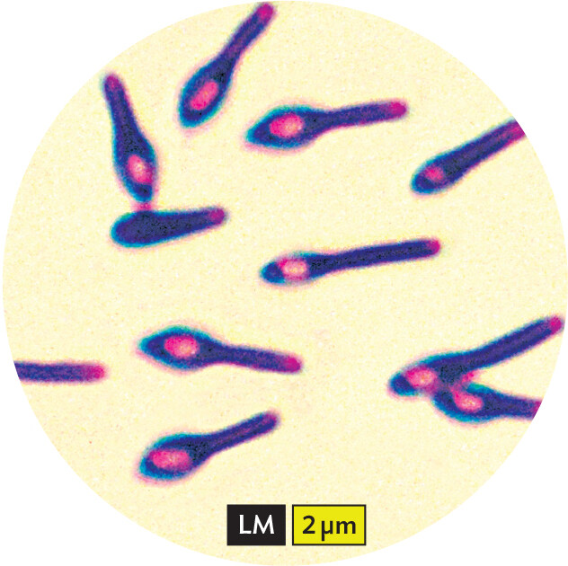 A light micrograph of Clostridium botulinum bacteria.