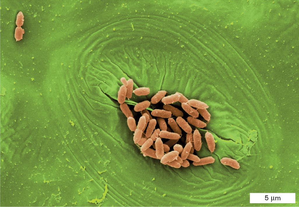 Four colorized micrographs of different kinds of microbes are shown. A micrograph shows rod shaped cells of the bacterium E. coli on a leaf stomate.</p>