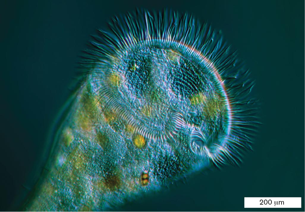 A micrograph shows the eukaryote Stentor, which has a long body and flattened top lined with thin hairs.