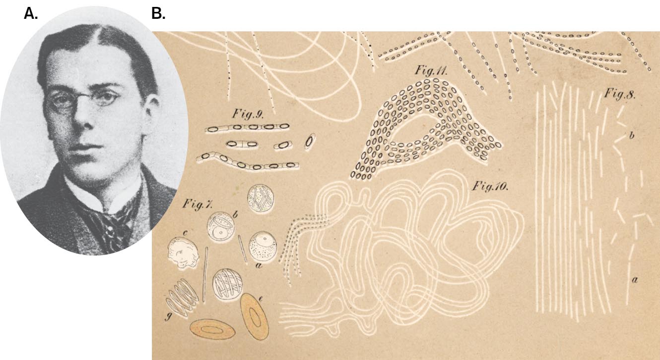 A headshot of Robert Koch and a sketch of anthrax bacilli. A headshot of Robert Koch as a university student. A sketch of anthrax bacilli in mouse blood.