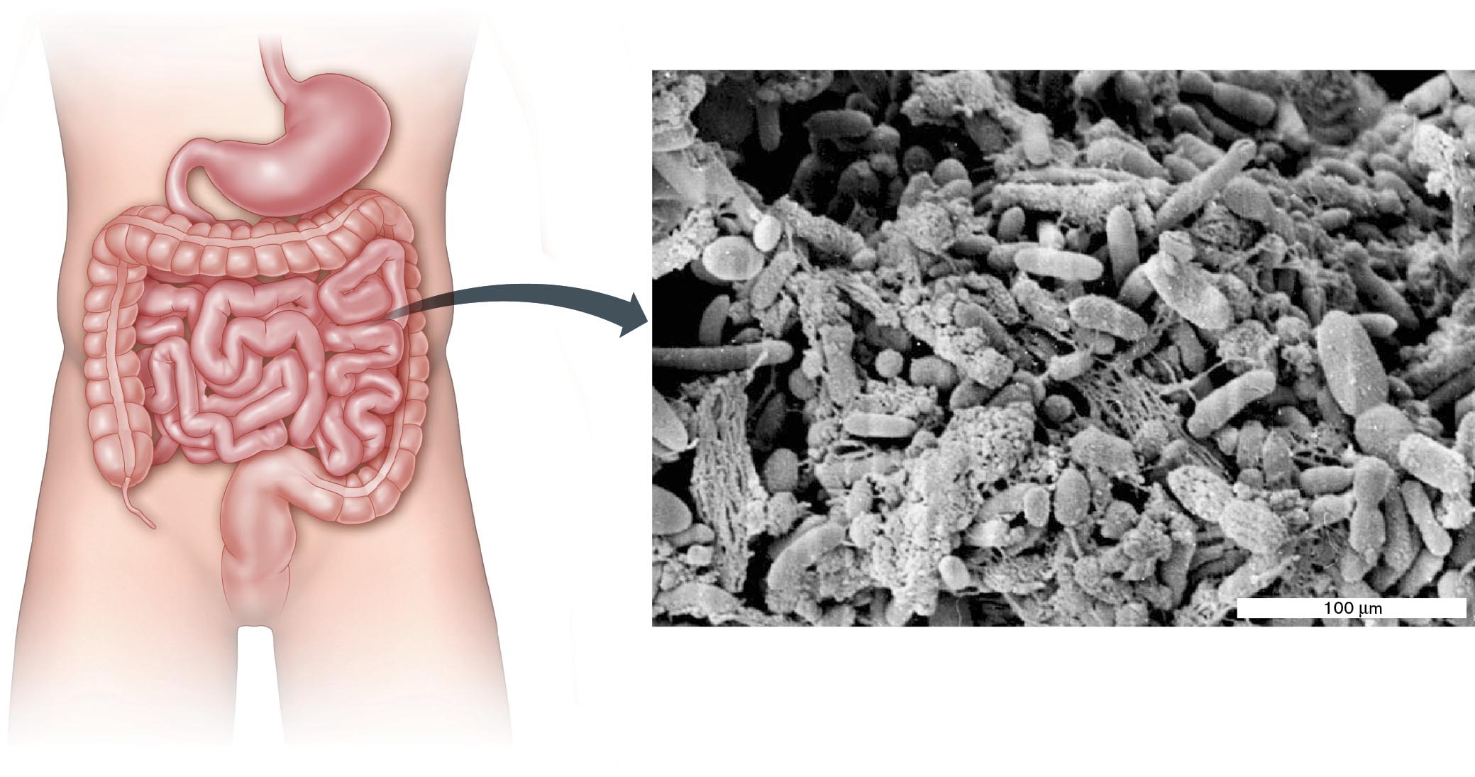 A diagram of a human digestive tract connected to an enlarged electron micrograph of a bacterial biofilm. A diagram of a human digestive tract connected to an enlarged electron micrograph of a bacterial biofilm.