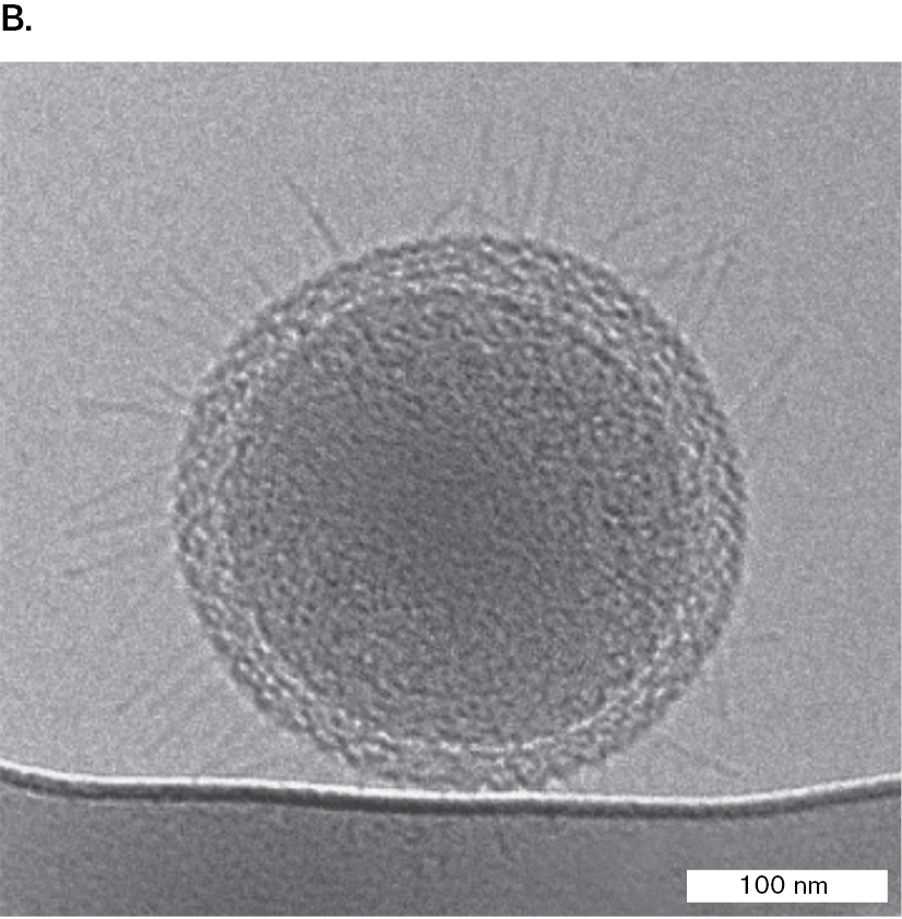 A micrograph of an ultrasmall coccoid bacterium.