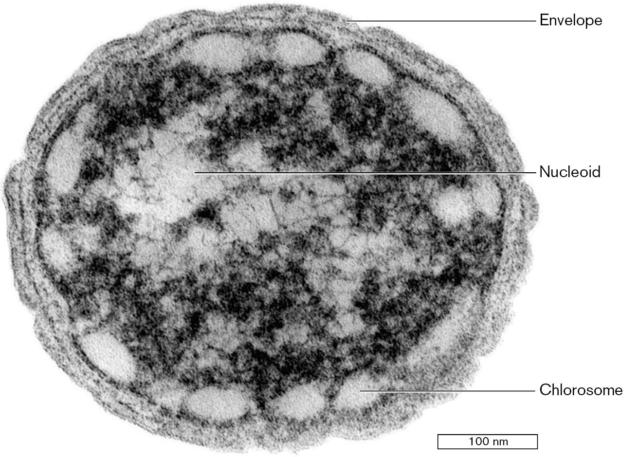 An electron micrograph of Chlorobium species.