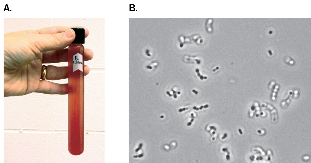 A photo of a bacterial culture tube and a micrograph of coccoid bacteria are shown. A photo of a human hand holding a tube containing a culture of Rhodospirillum rubrum. A micrograph of coccoid cells of Oenococcus oeni.