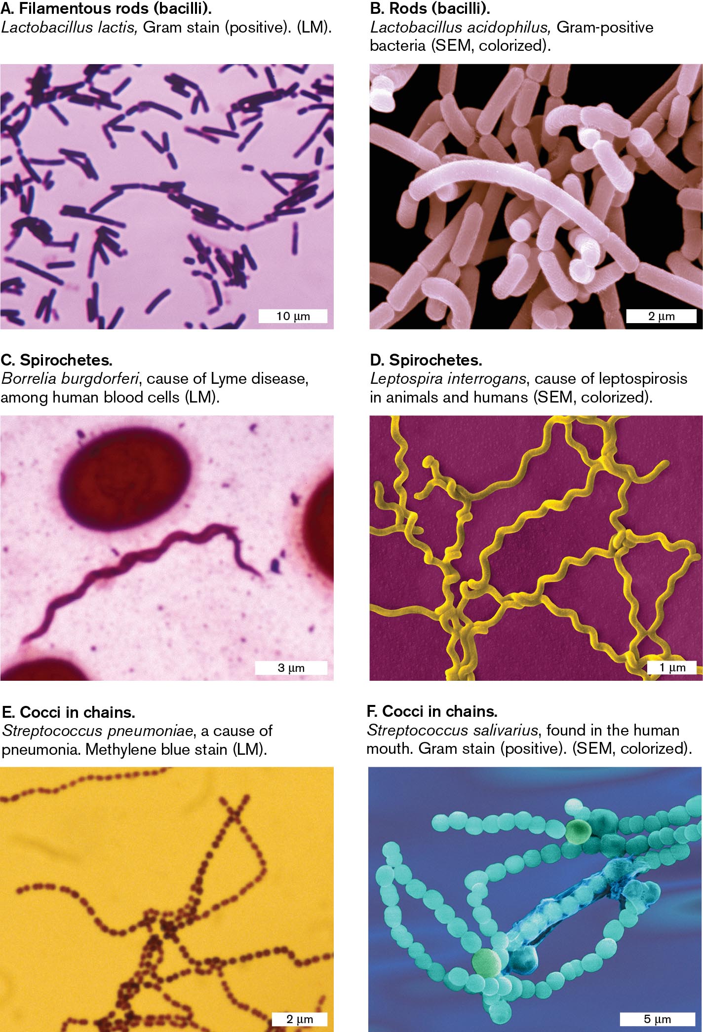 Six micrographs show examples of the common shapes seen in bacterial cells. A micrograph of Lactobacillus lactis, a filamentous rod shaped bacterium, as seen under a light microscope. A micrograph of Lactobacillus acidophilus, a rod shaped bacterium, as seen with a scanning electron microscope. A micrograph of Borrelia burgdorferi, a spirochete shaped bacterium, as seen under a light microscope. A micrograph of Leptospira interrogans, a spirochete shaped bacterium, as seen with a scanning electron microscope. A micrograph of Streptococcus pneumoniae, a coccus shaped bacterium, as seen under a light microscope. A micrograph of Streptococcus salivarius, a coccus shaped bacterium, as seen with a scanning electron microscope.