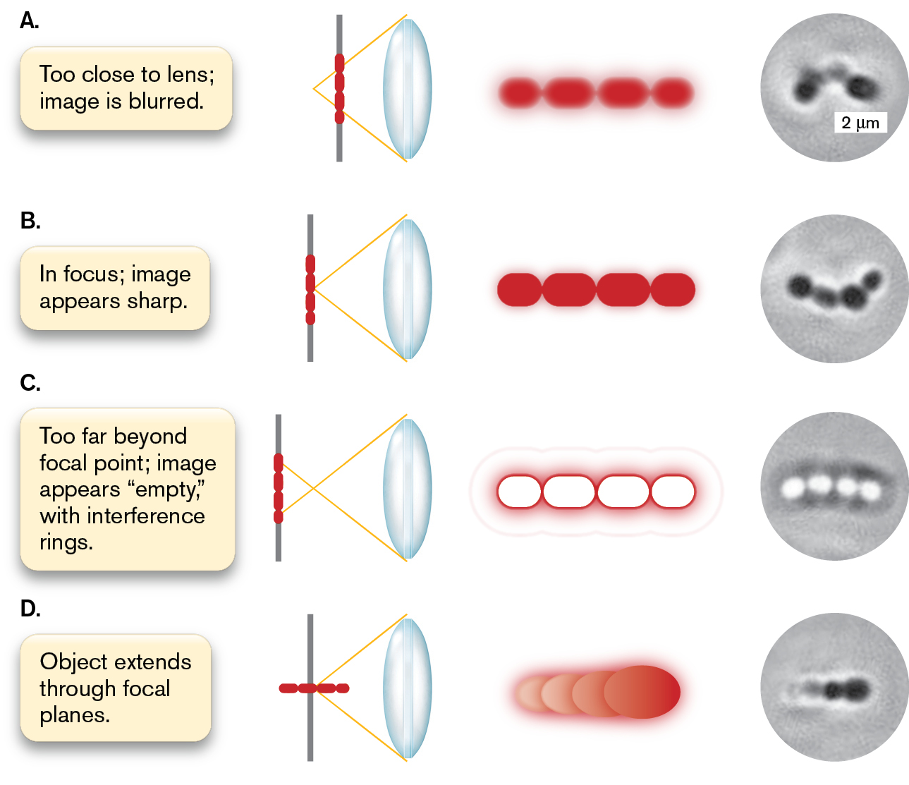 Four micrographs of bacteria are shown at different levels of focus. Micrograph A is blurred because the microscope lens is too close to the slide. Micrograph B appears sharp because it is in focus. Micrograph C appears empty because the focus is too far beyond the focal point. Micrograph D the object structure is difficult to distinguish because the object extends through focal planes.