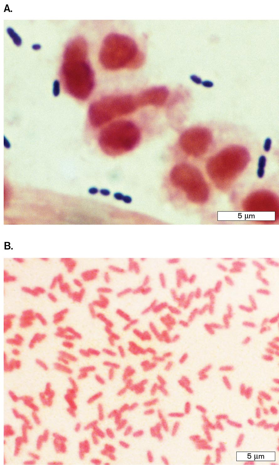 Two micrographs show examples of Gram-positive and Gram-negative bacteria. A micrograph of diplococci Gram-positive Streptococcus pneumoniae bacteria. A micrograph of rod shaped Gram-negative Proteus mirabilis bacteria.