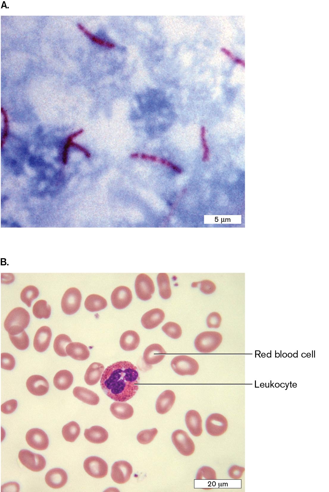 Two micrographs show examples of acid-fast stain and Giemsa stain as seen with light microscopy. A micrograph of Mycobacterium tuberculosis stained with acid-fast stain. A micrograph of human blood cells stained with Giemsa stain.