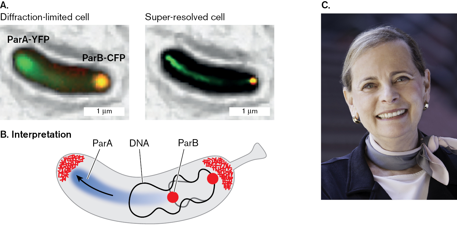 Two super resolution images of origin binding proteins, an illustrated interpretation, and a photo of Lucy Shapiro. Two super resolution images of origin binding proteins in Caulobacter crescentus. An illustrated interpretation of Par A protein migration through a cell. A photo of Lucy Shapiro.