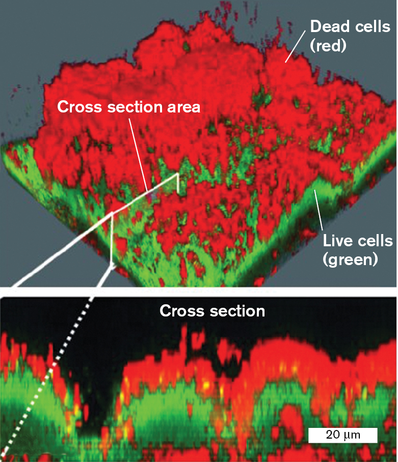 Two confocal laser scanning micrographs show the observation of a biofilms with live and dead cells containing a fluorophore.