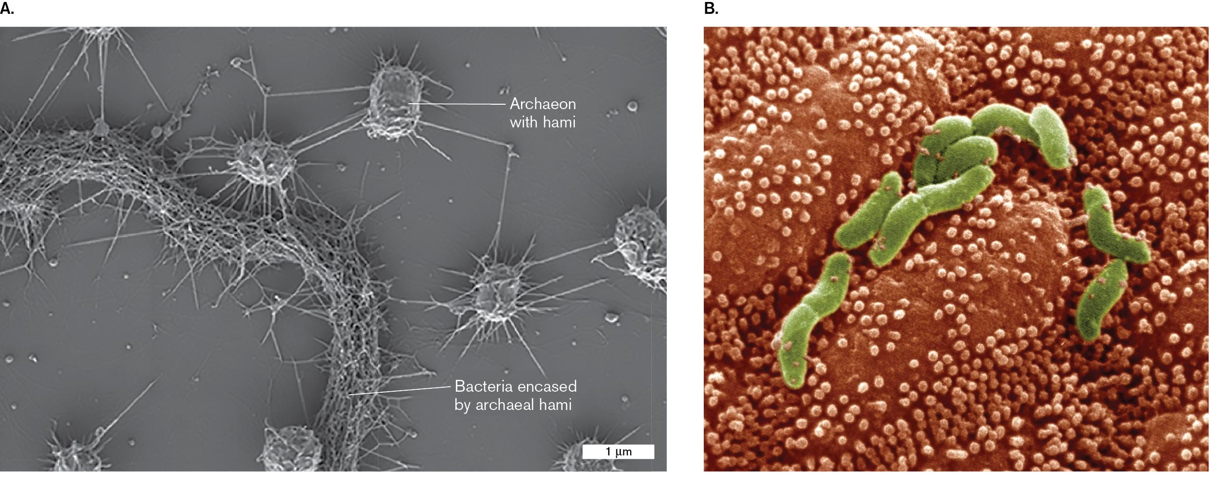 Two scanning electron micrographs of an archaeon and Helicobacter pylori are shown. A scanning electron micrograph of archaea of a wetland biofilm. A scanning electron micrograph shows the rod shaped bacterial cells of Helicobacter pylori.