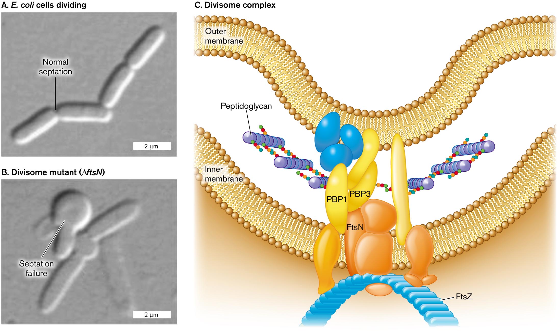 Two micrographs of cell division and an illustration of the divisome complex. A micrograph of E. coli cells dividing with normal septation. A micrograph of E. coli septation failure in a divisome mutant. An illustration of the structure of the divisome complex.