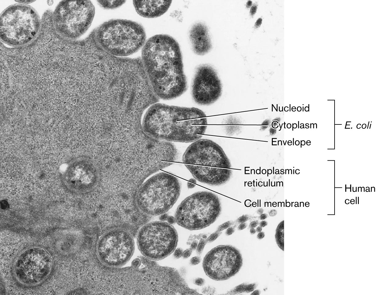 A microscopic image shows bacteria invading a human cell.