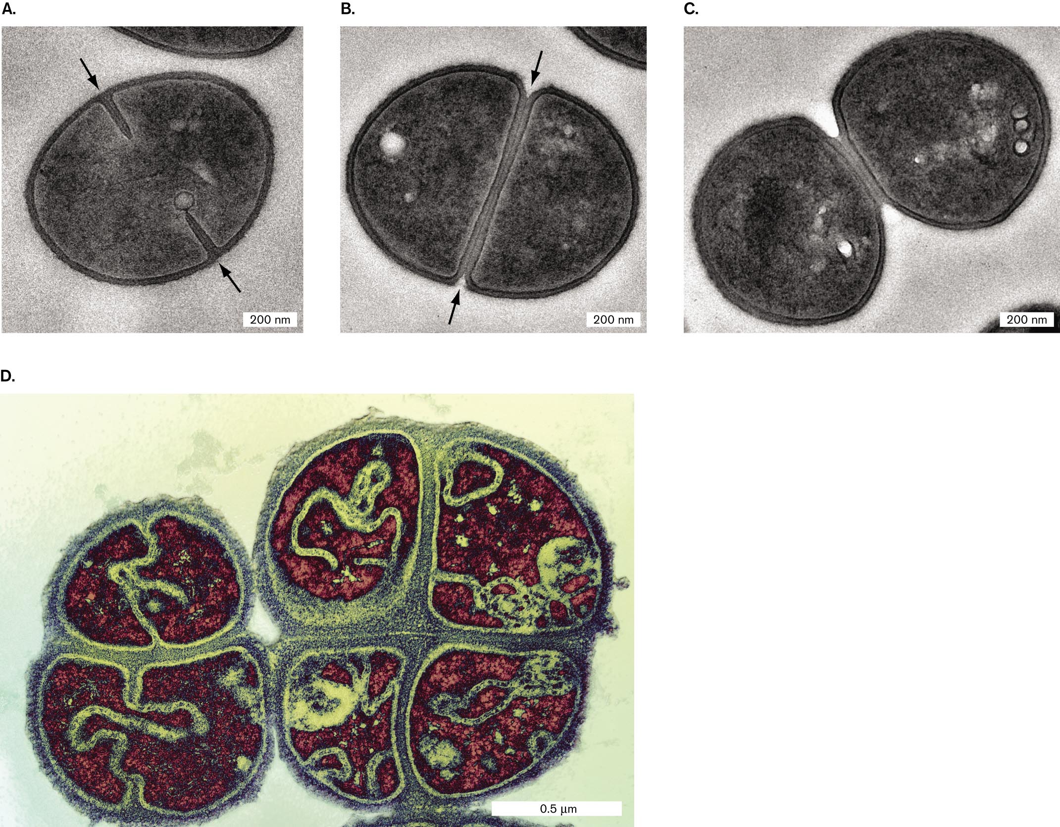 Four transmission electron micrographs of septation without cell elongation. A transmission electron micrograph of fission within Staphylococcus aureus. A transmission electron micrograph of complete envelope partitioning in Staphylococcus aureus. A transmission electron micrograph of Staphylococcus aureus daughter cells. A transmission electron micrograph of septation in Micrococcus tetragenus.