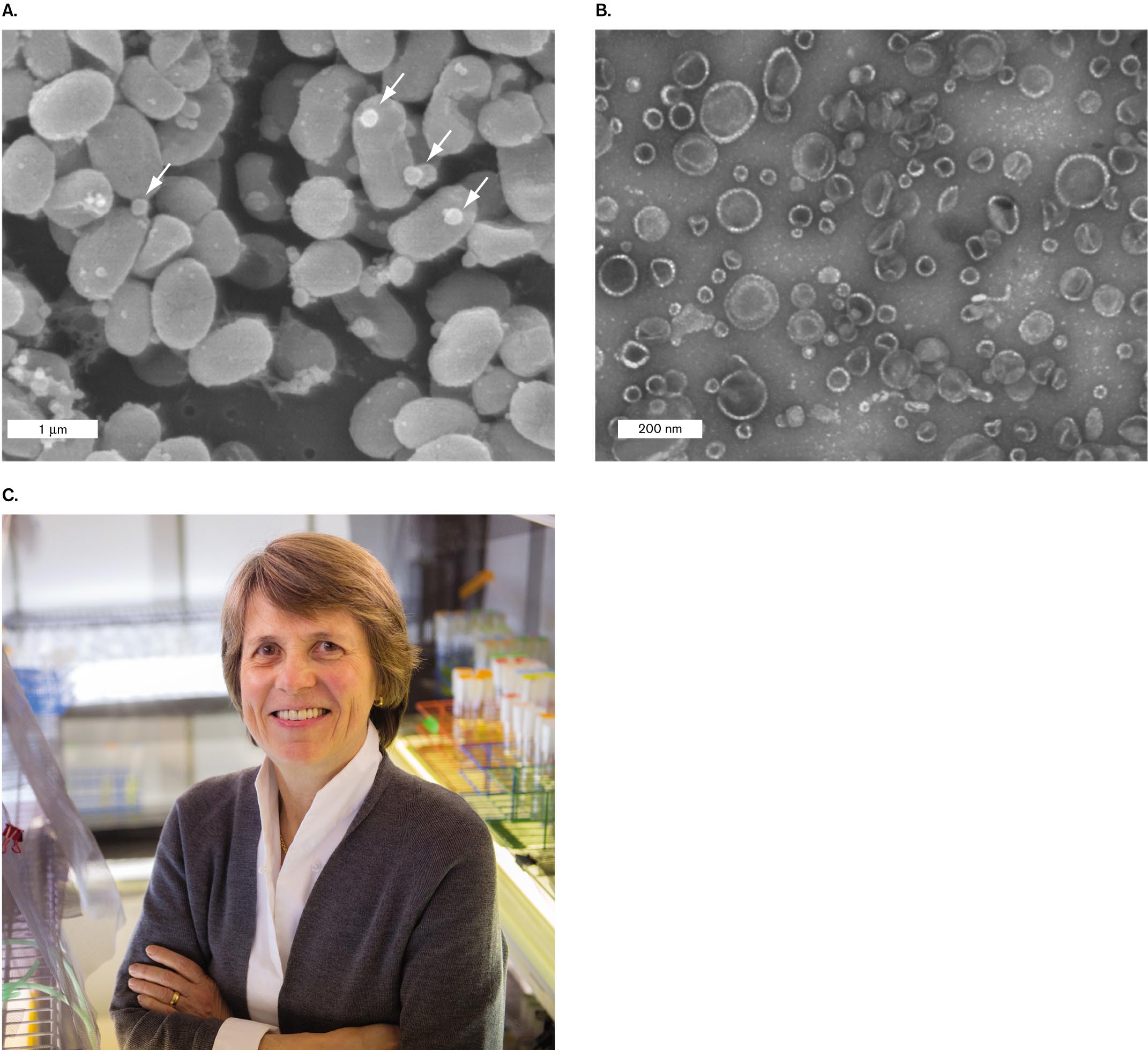 Two micrographs of Prochlorococcus cyanobacteria and a photograph of Sallie Chisholm. A scanning electron micrograph of Prochlorococcus cyanobacteria releasing vesicles of the cell membrane. A transmission electron micrograph of Prochlorococcus vesicles. A photograph of Sallie Chisholm smiling at the camera.