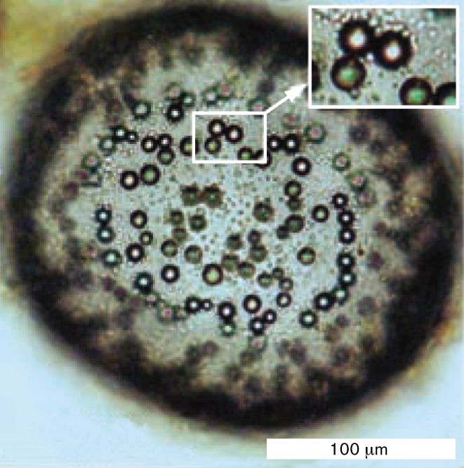 A micrograph of sulfur globules in the cytoplasm of Thiomargarita namibiensis.