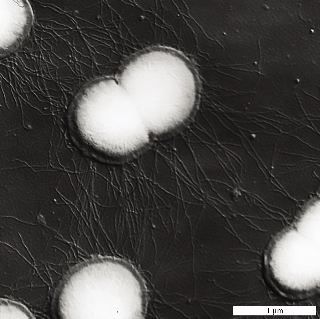 An electron micrograph shows the attachment of protein filaments.