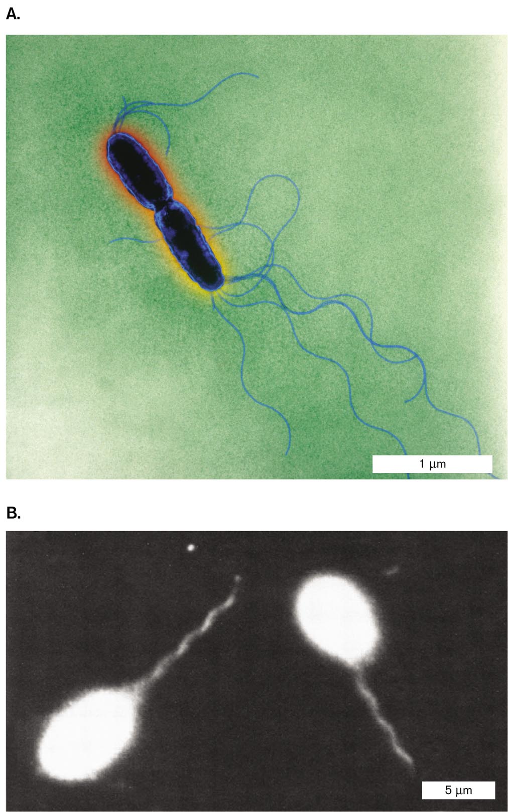 Two micrographs of Salmonella enterica. A transmission electron micrograph of Salmonella enterica. A dark-field micrograph of Salmonella enterica.