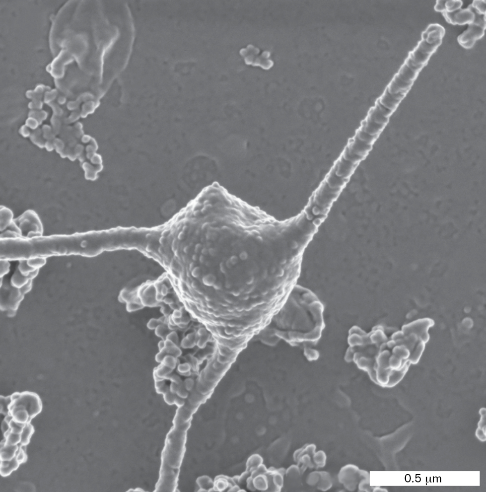 A micrograph shows a circular cell, about 1 micrometer in diameter, with three extended tentacle features.