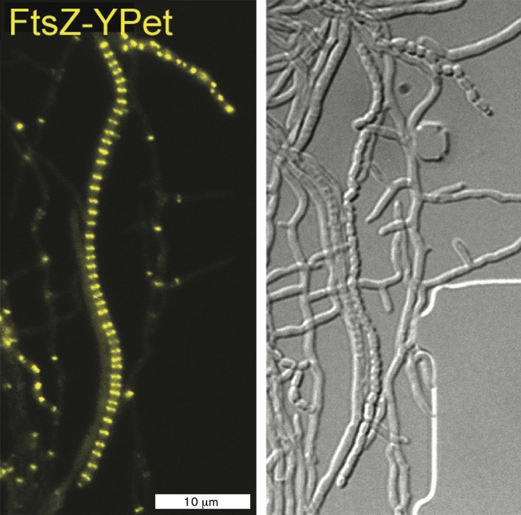 A fluorescent micrograph of a sporogenic hyphae of S. venezuelae.