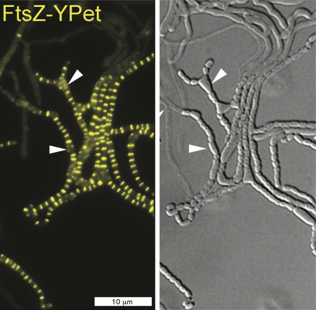 A fluorescent micrograph of a sporogenic hyphae of a mutated S. venezuelae.