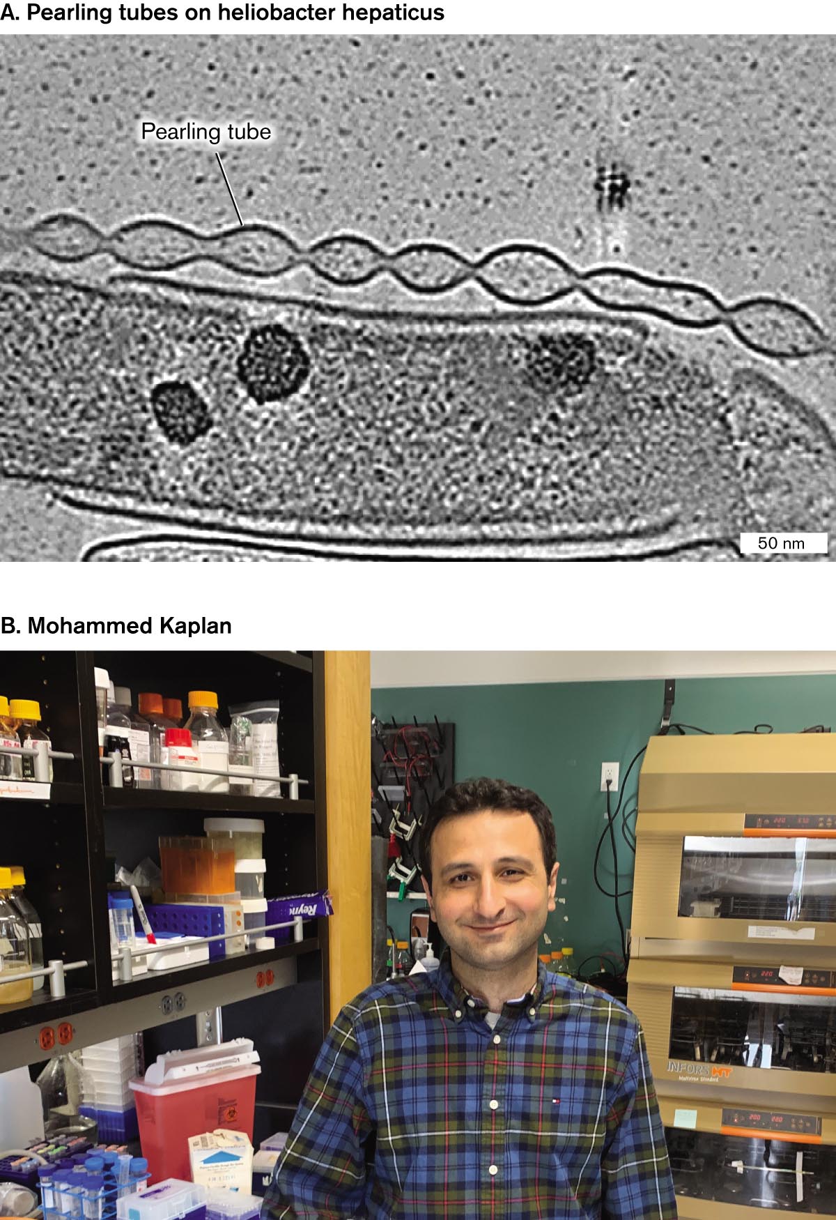 A micrograph of pearling tubes on Helicobacter hepaticus and a photo of Mohammed Kaplan. A cryo-electron micrograph of pearling tubes on Helicobacter hepaticus. A photo of Mohammed Kaplan in a laboratory.