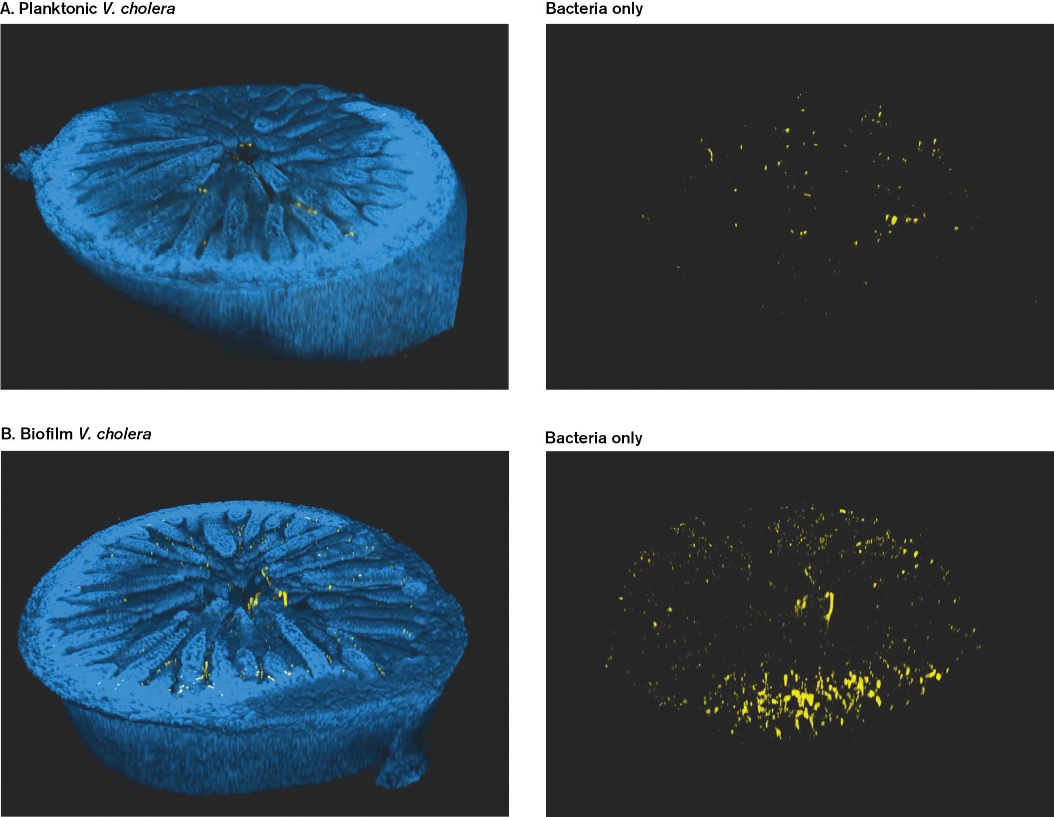 Four MiPACT images of planktonic and biofilm Vibrio cholerae within the mouse gut epithelium. MiPACT imaging of planktonic Vibrio cholerae within the mouse gut epithelium. MiPACT imaging of planktonic Vibrio cholerae. MiPACT imaging of biofilm Vibrio cholerae within the mouse gut epithelium. MiPACT imaging of biofilm Vibrio cholerae.