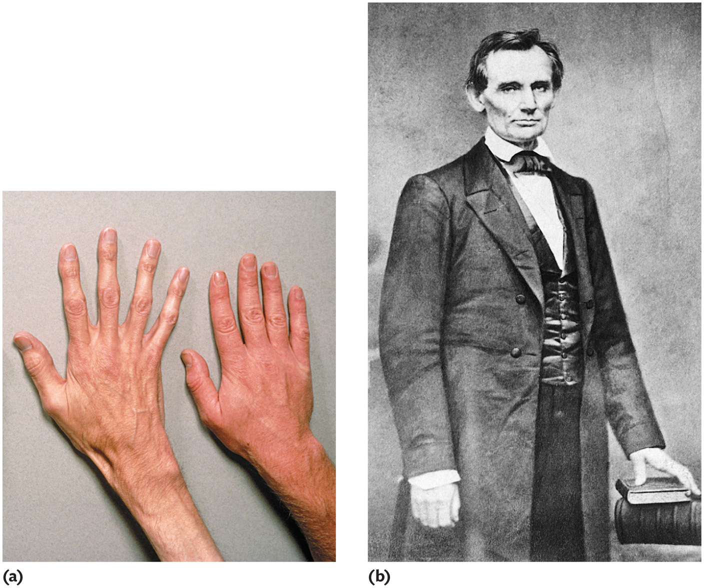 Two hands next to each other: one is average and the other is much longer and thinner.; A portrait of Abraham Lincoln dressed in formal clothing with his left hand on a stack of books.