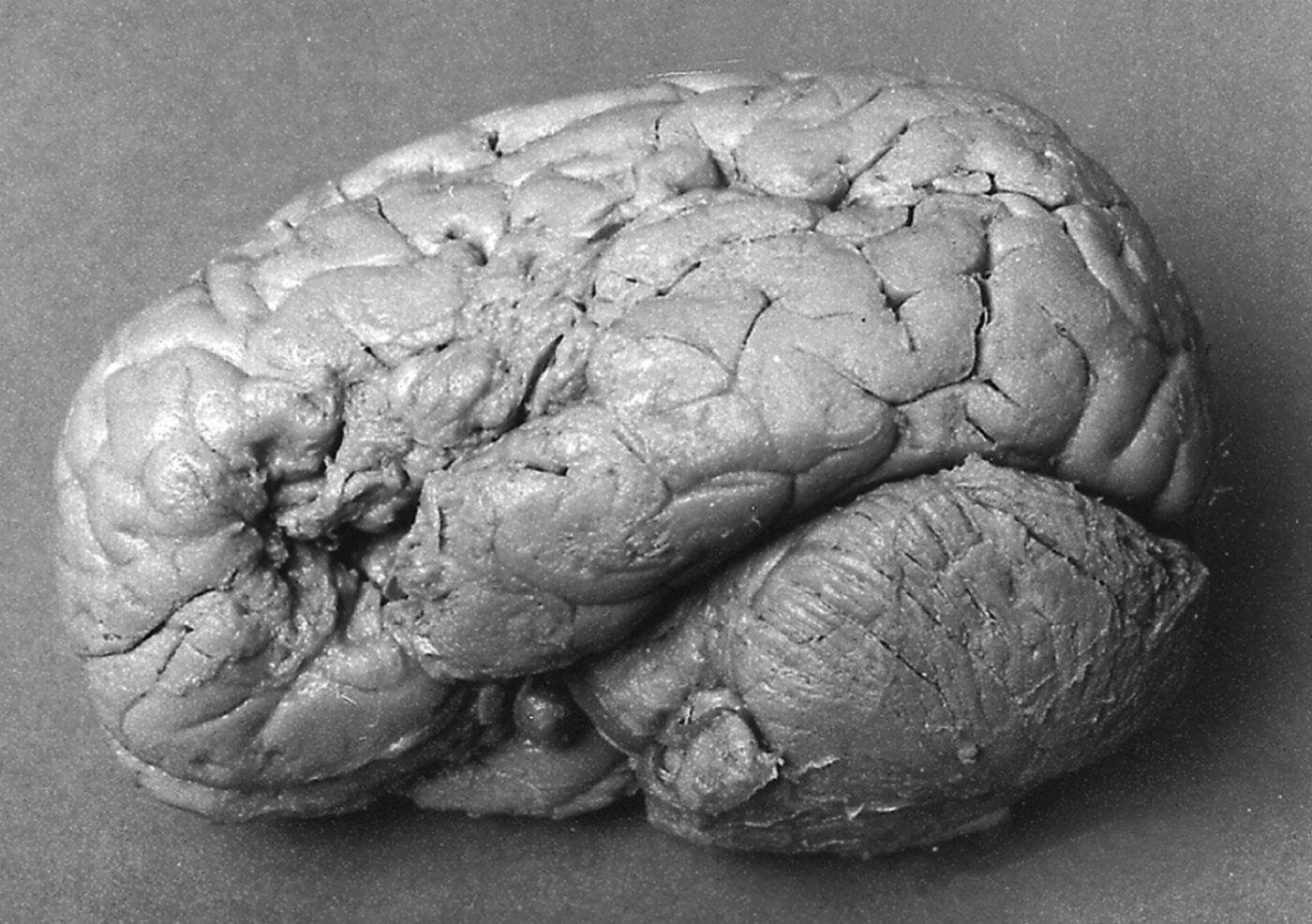 A human brain.