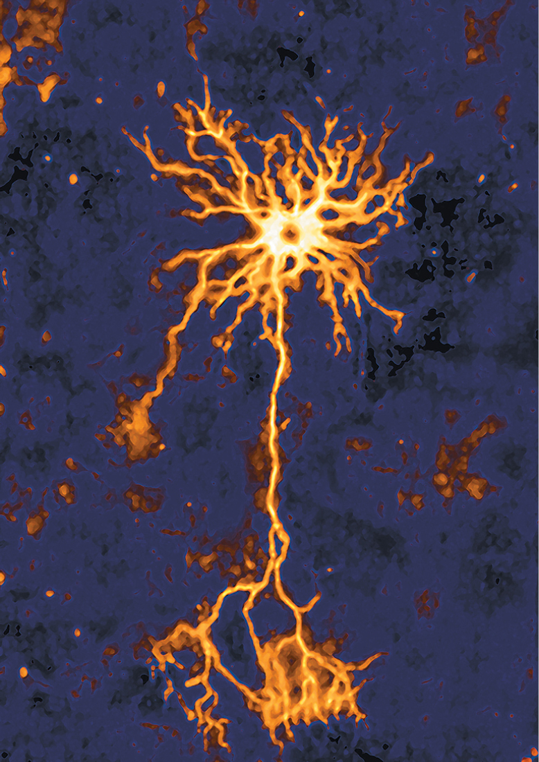 An image of a nerve cell or neuron.