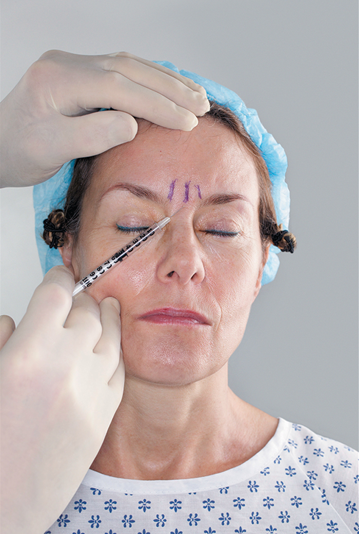 A woman wearing a scrub cap with lines drawn on her brow is receiving a Botox injection.