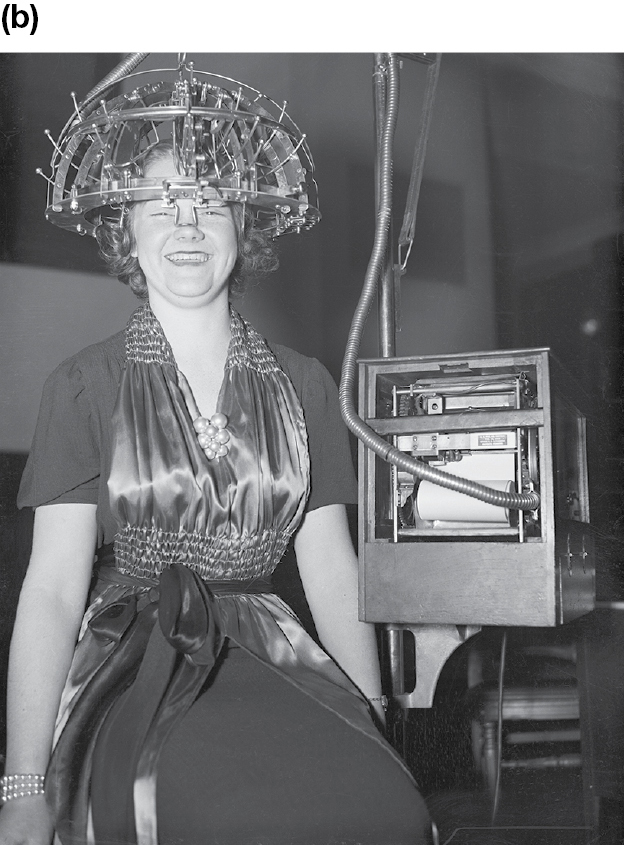 A black and white photograph shows a woman in a nice dress with some sort of device connected to her head.