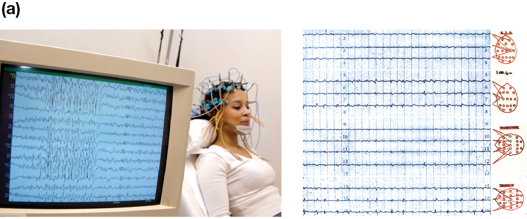 A picture of a monitor showing electroencephalographs brain wave measurements and a woman who is hooked up to one in the background.