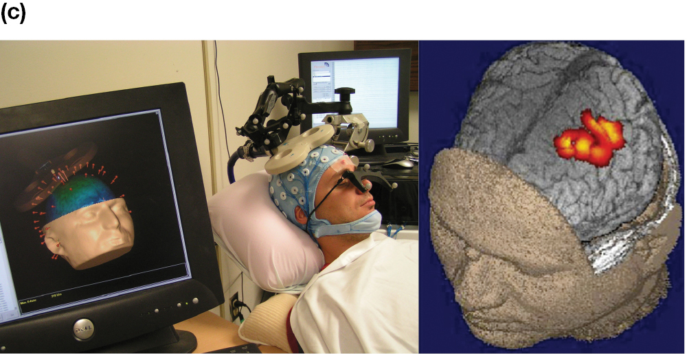 A picture of a monitor showing a 3-d representation of the brain next to a person who is hooked into transcranial magnetic stimulation.