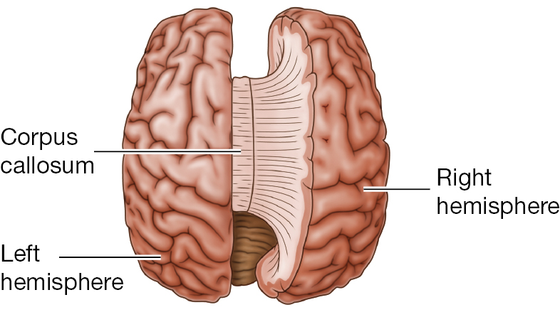 A diagram of the Corpus Callosum connecting the right and left hemispheres of the brain.