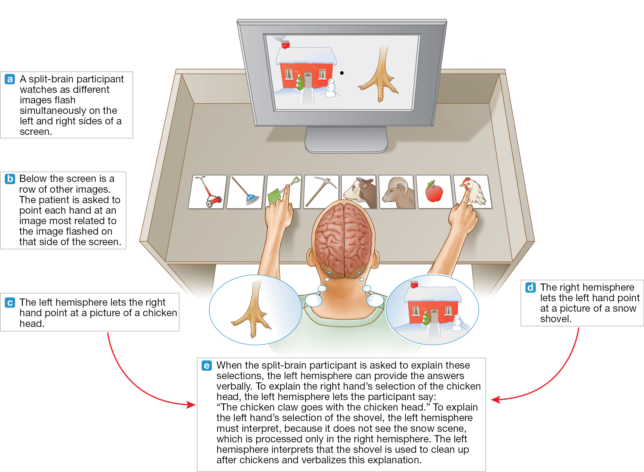 An illustration shows an activity performed by a split-Brain patient.