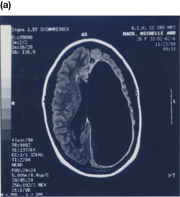 A photo of a brain scan.