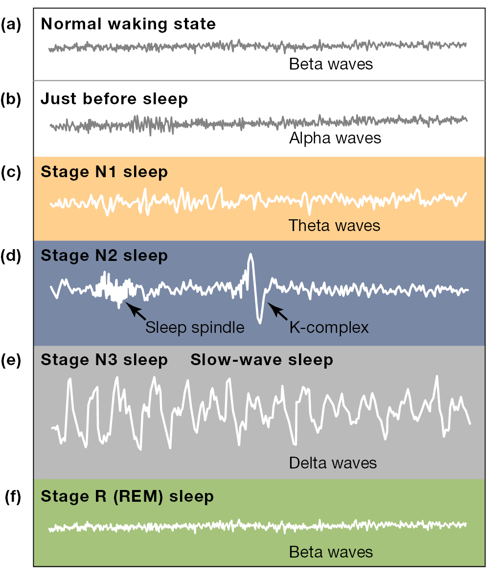 Six examples of brain waves from an E E G ranging between the normal waking state and R E M.