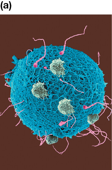 An image shows an egg that is in the process of accepting sperm.