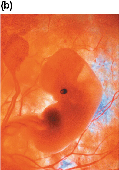 An Image shows an embryo in the amniotic sac. The fetus is barely formed and does not look like a human yet.