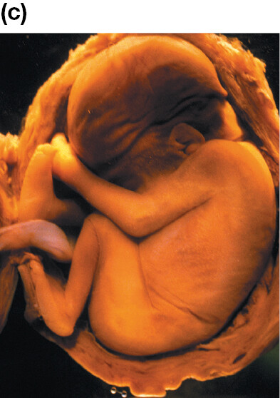 An image shows a fetus curled up inside the stomach. It has formed legs, arms, ears, and trunk. It looks very much like a newborn child.