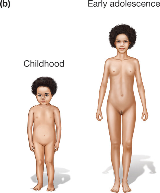 An illustration shows two females one in childhood and one in early adolescence.